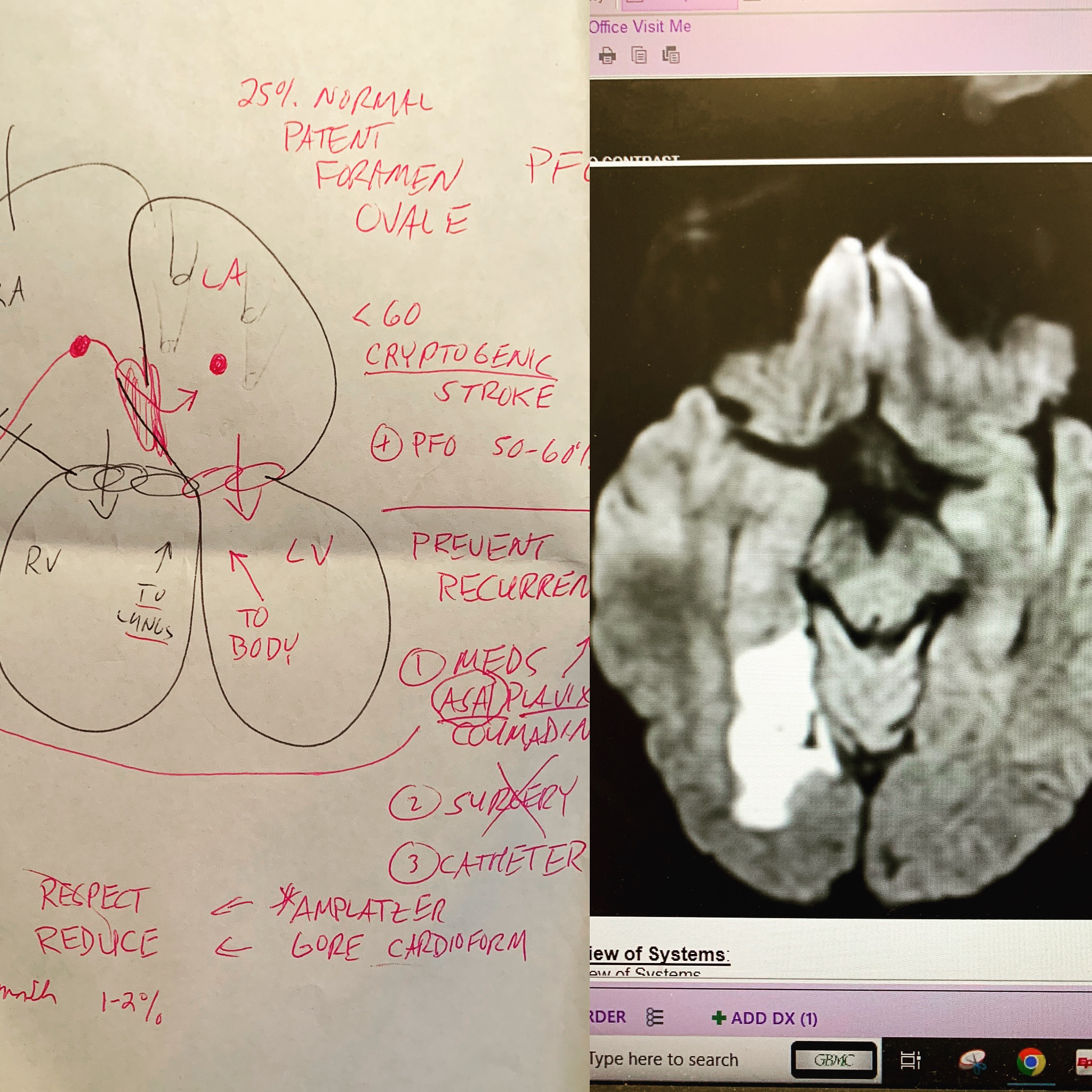 Medical documentation of stroke experience - brain scan and clinical notes